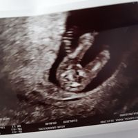 Futuras mamas octubre 2020 - 1
