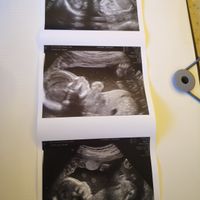 Futuras mamis Febrero 2021 - 1