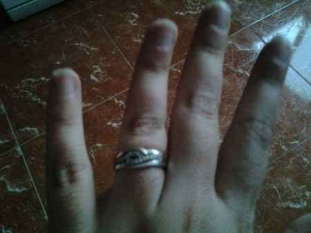 mi anillo de pedida...