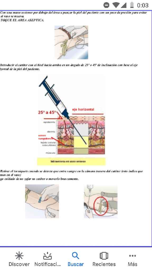 Heparina Innohep 4500 dónde pinchar??? - 1