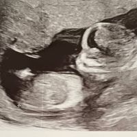 Futuras mamás Abril 2023 (actualizado) - 1