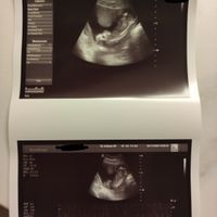 Futuras mamás Abril 2023 (actualizado) - 1