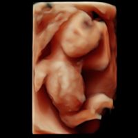 Futuras mamás Abril 2023 (actualizado) - 1