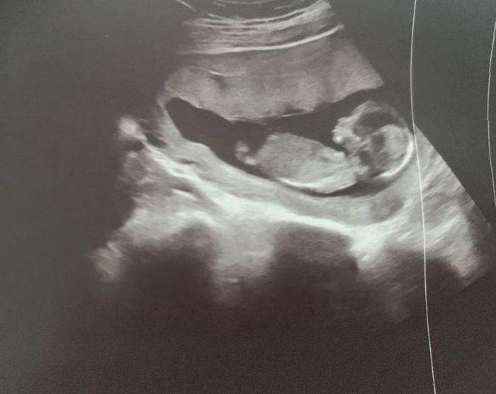 Futuras mamas Diciembre 2020 - 1