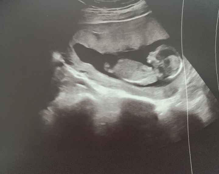 Futuras mamas Diciembre 2020 - 1