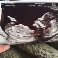 12 semanas y me dicen que parece chico - 1