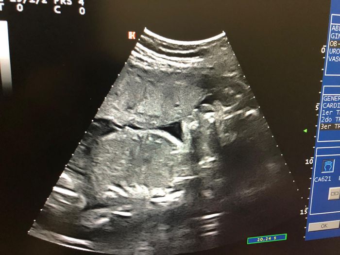 Futuras mamás marzo 2019 - 1