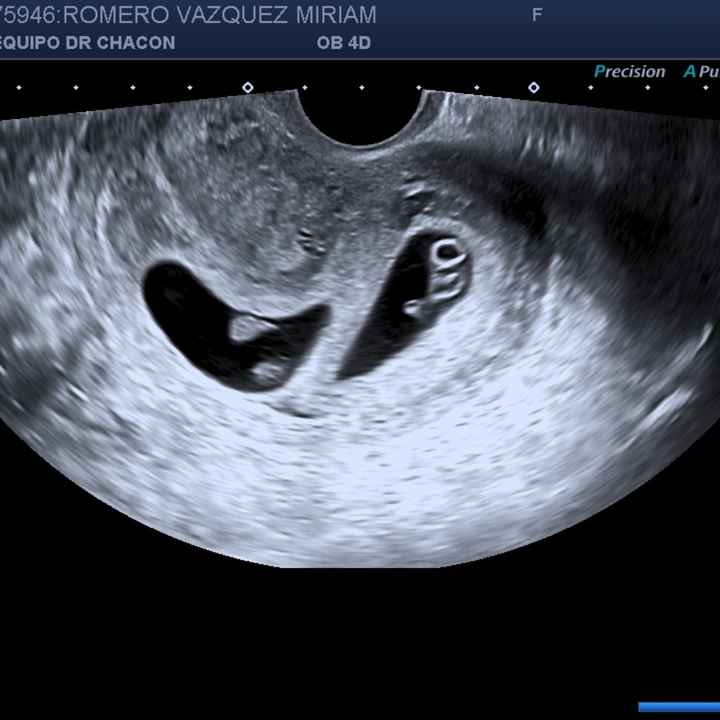 Futuras mamis junio 2021 🤰🏻❤️ oficial - 1