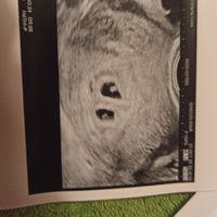 Futuras mamás julio 2021🤰🌹😍😍 - 1