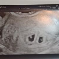 Futuras mamis junio 2021 🤰🏻❤️ oficial - 1