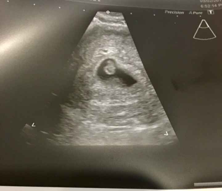 Futuras mamis octubre 2017!!!! - 1