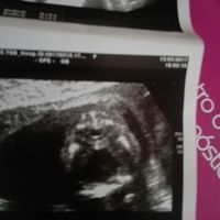Mamis agosto 2017 - 1