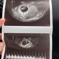 Futuras Mamas Julio 2020. - 1