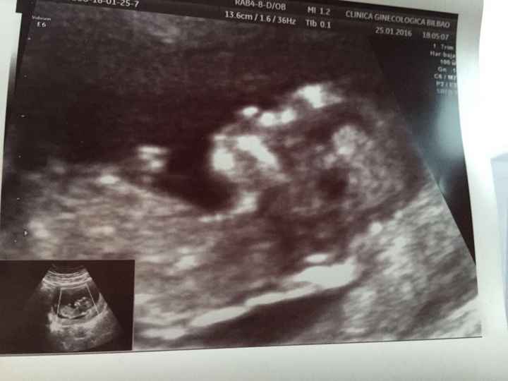 ¡¡futuras mamás agosto 2016!! - 2