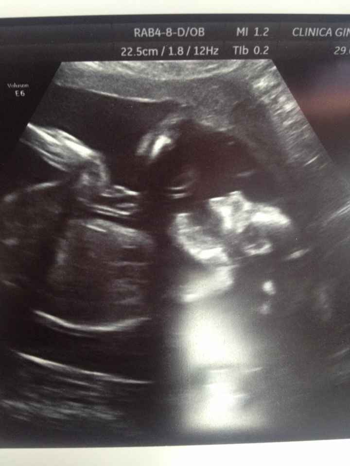 ¡¡futuras mamás agosto 2016!! - 1