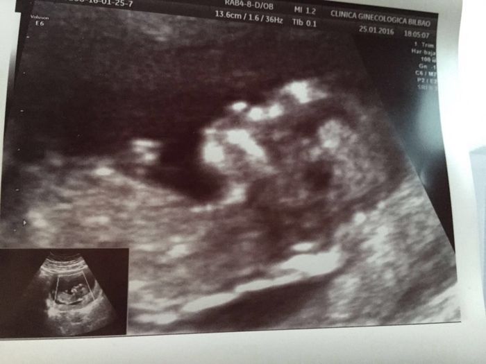 ¡¡futuras mamás agosto 2016!! - 2