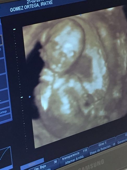 ¡¡futuras mamás agosto 2016!! - 1