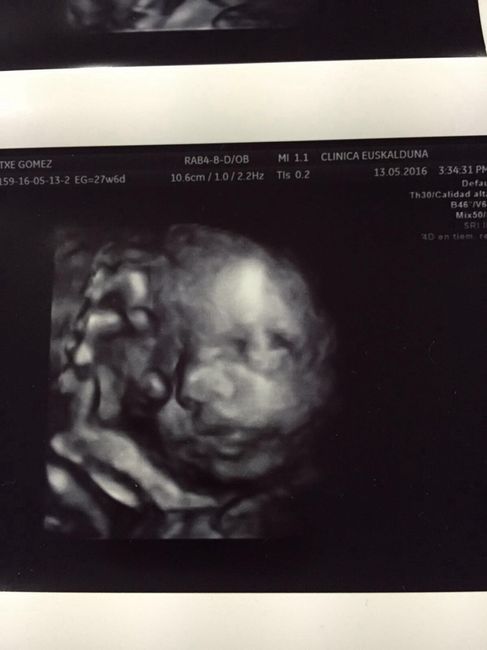 ¡¡futuras mamás agosto 2016!! - 2