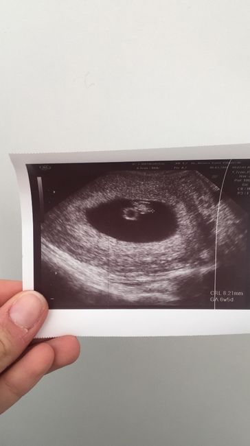 6+5 eco vaginal