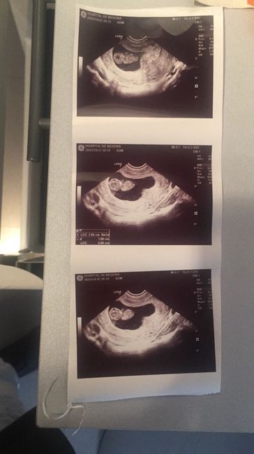 Vaginal 9+3