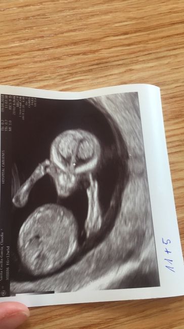 VAGINAL 11+5