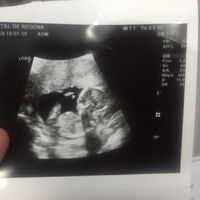 15 semanas