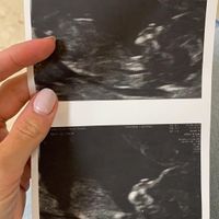 Futuras mamas Diciembre 2020 - 1