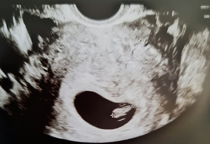 Futuras mamás Octubre 2022 🤰♥️ 1
