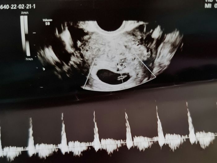 Futuras mamás Octubre 2022 🤰♥️ 2