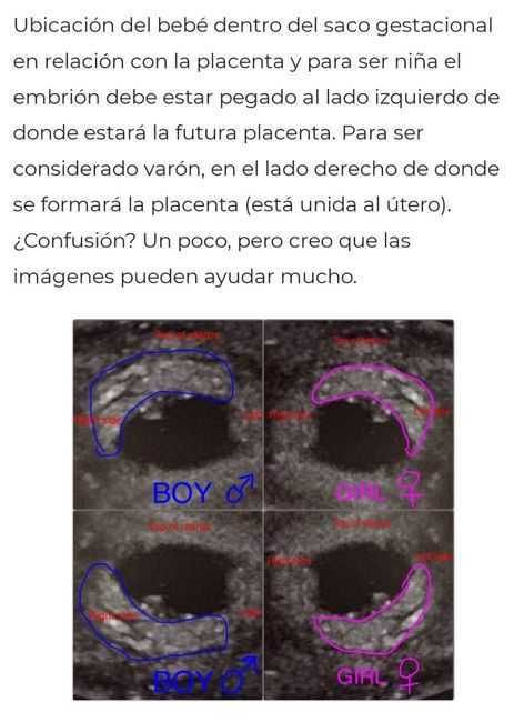 Futuras mamás Octubre 2022 🤰♥️ 2