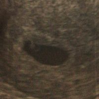 Futuras mamás enero 2019 - 1