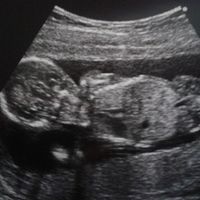 El consultorio de Lita para futuras mamis - 1