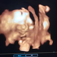 Mamas Marzo 2020 - 2