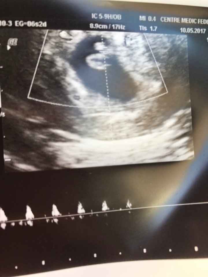 Futuras mamis diciembre 2017 - 2