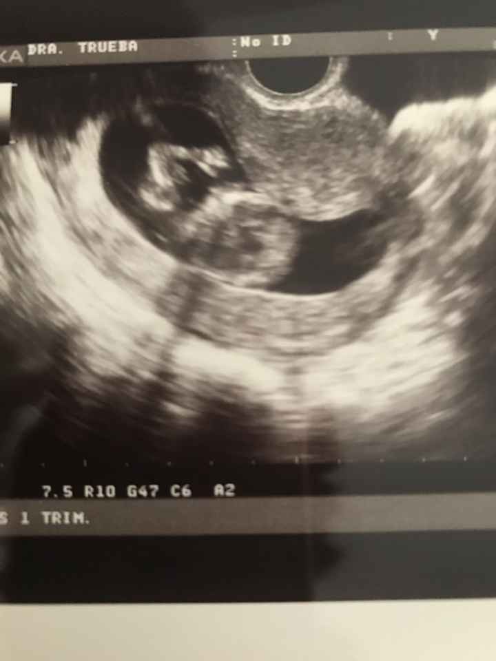 Futuras mamis diciembre 2017 - 2
