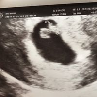 Futuras mamis diciembre 2017 - 1