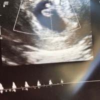 Futuras mamis diciembre 2017 - 2