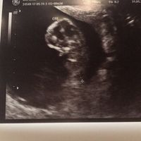 Futuras mamis diciembre 2017 - 1