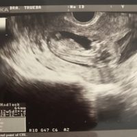 Futuras mamis diciembre 2017 - 1
