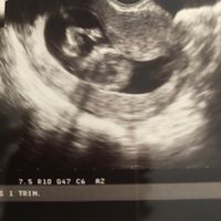 Futuras mamis diciembre 2017 - 2