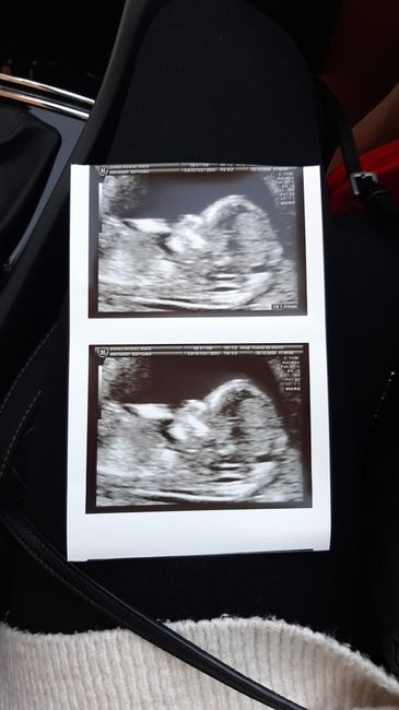 Futuras mamás julio 2021🤰🌹😍😍 - 1