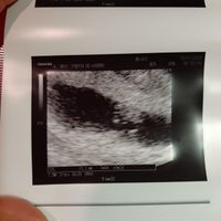 Futuras mamis junio 2021 🤰🏻❤️ oficial - 1