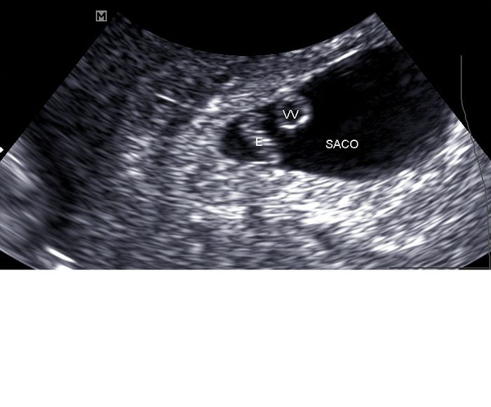 7 semanas