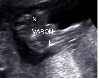 primera foto