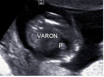 segunda foto