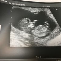 Ayuda con método ramzi: niño o niña? - 1