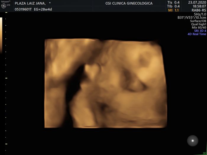 Futuras mamas octubre 2020 - 2
