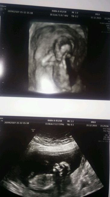 Futuras mamás junio 2016 - 1
