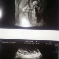 Futuras mamás junio 2016 - 1