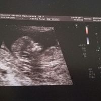 Futuras mamis diciembre 2017 - 1